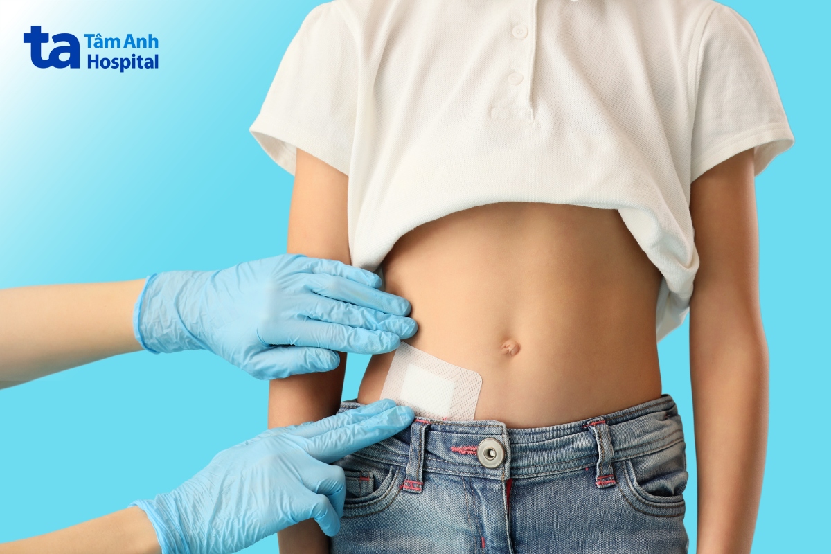 vết mổ ruột thừa nên tránh nước