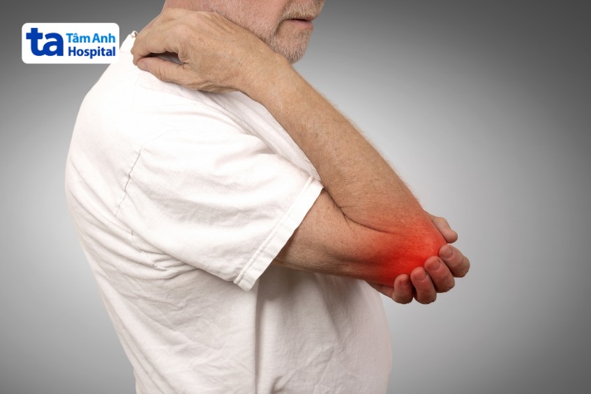 vị trí xuất hiện nốt thấp khớp