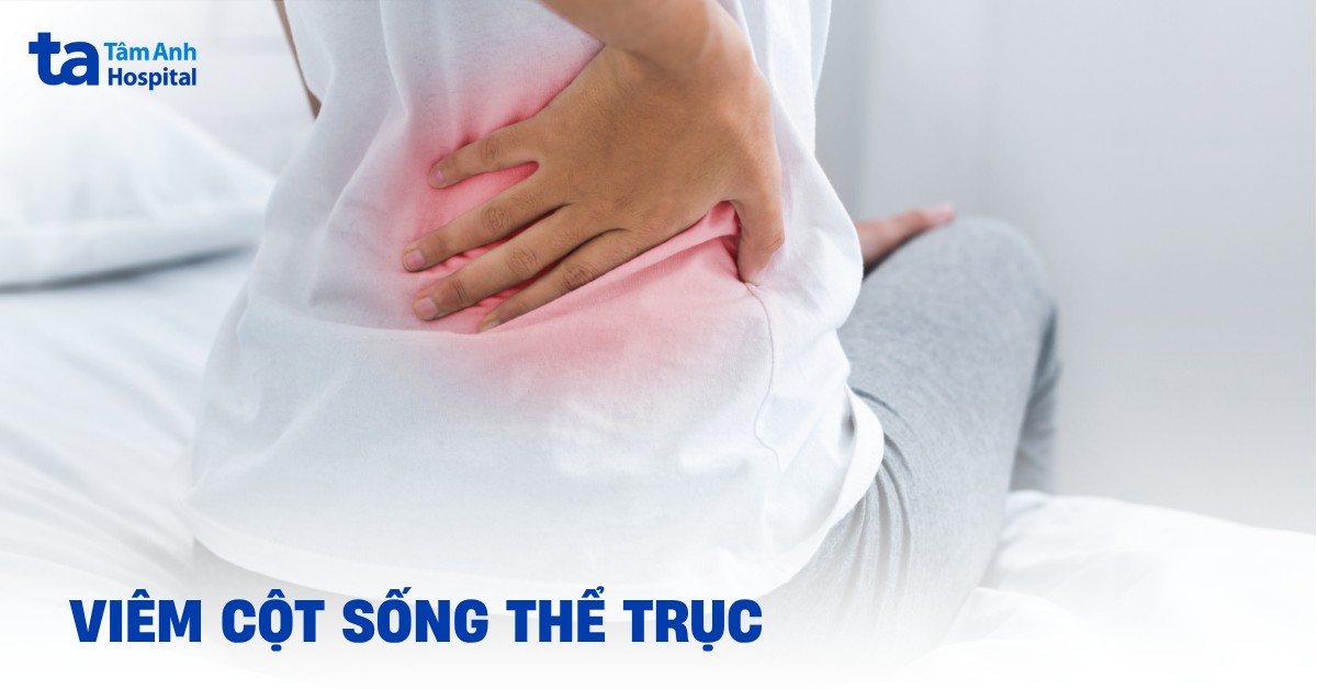 Tìm hiểu bệnh viêm cột sống thể trục