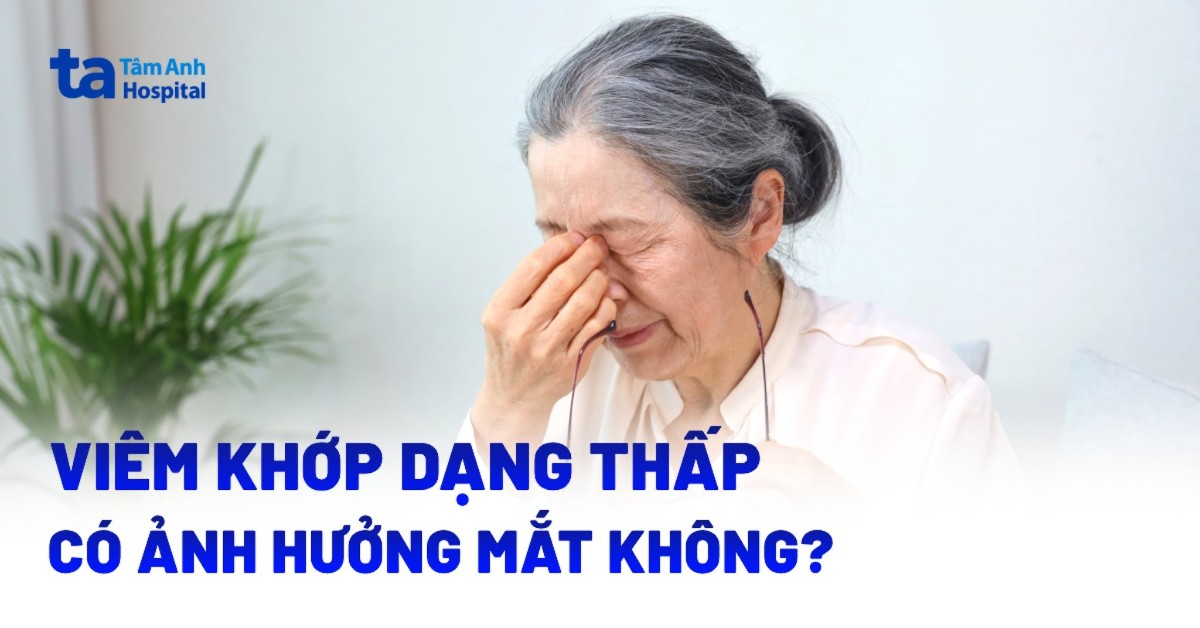 Viêm khớp dạng thấp có ảnh hưởng đến mắt không?