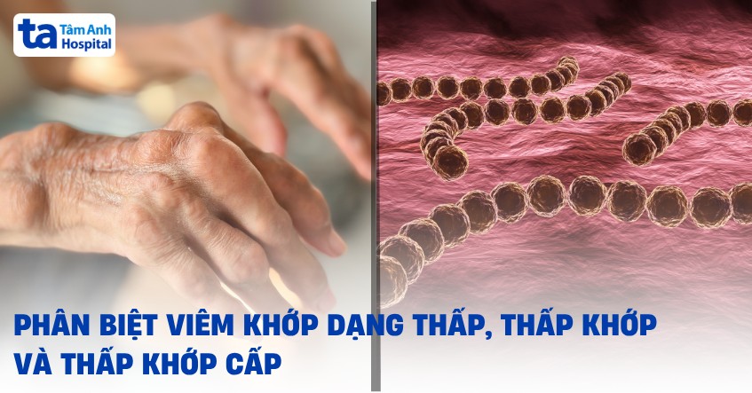 Phân biệt thấp khớp, thấp khớp cấp và viêm khớp dạng thấp​
