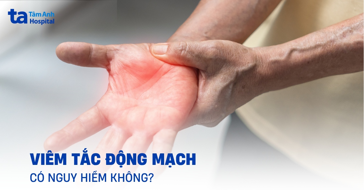 Viêm tắc động mạch: Những điều cần biết