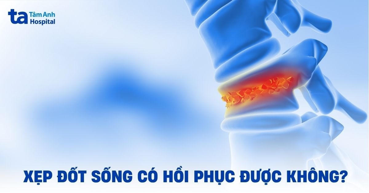 xẹp đốt sống có hồi phục được không