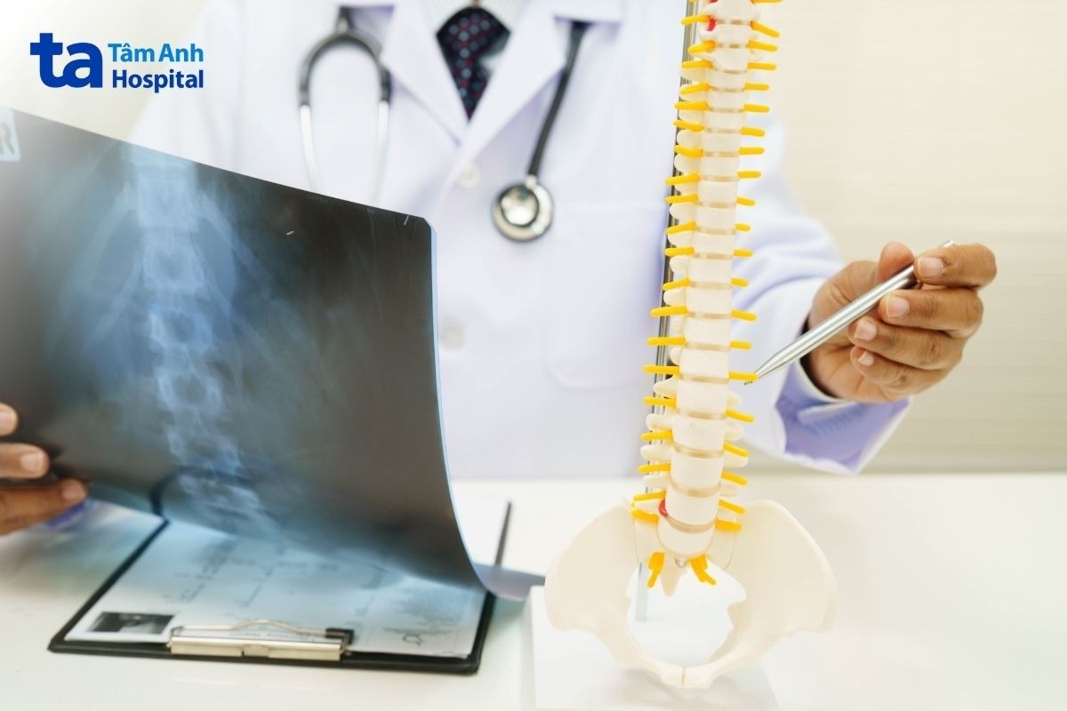 Xẹp Đốt Sống D12 Có Nguy Hiểm Không