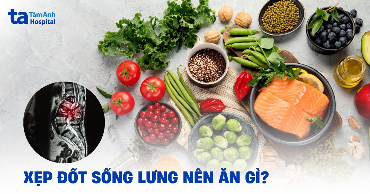 Xẹp đốt sống lưng nên ăn gì để nhanh phục hồi?