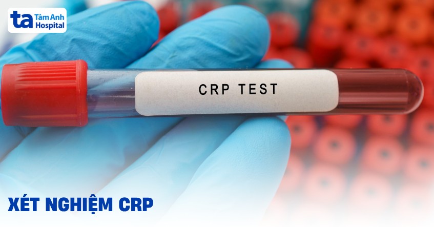 Xét nghiệm CRP là gì? Cách đọc hiểu chỉ số, kết quả