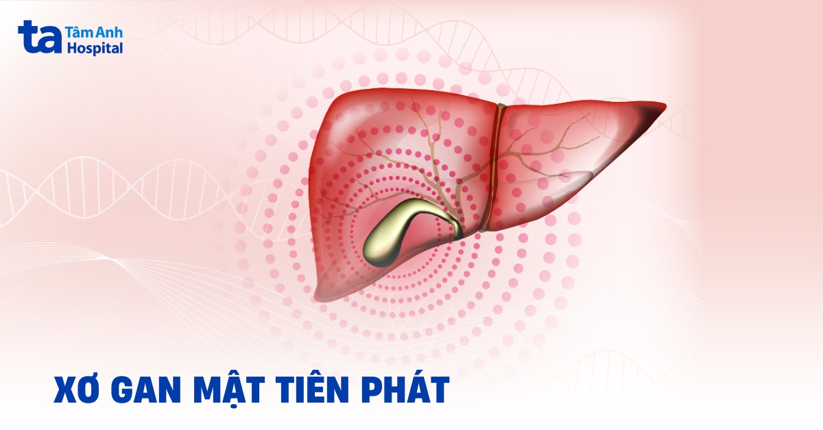 Xơ gan mật tiên phát: Căn bệnh hiếm gặp cần chú ý