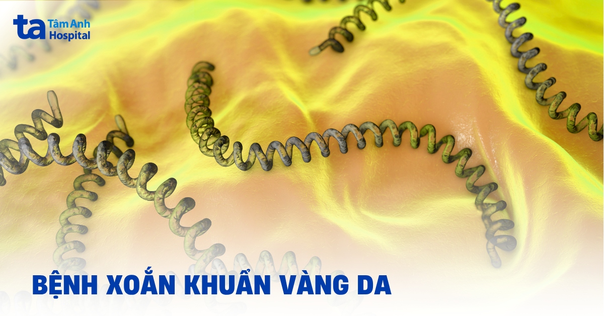 Bệnh xoắn khuẩn vàng da (Leptospira): Dấu hiệu nhận biết sớm