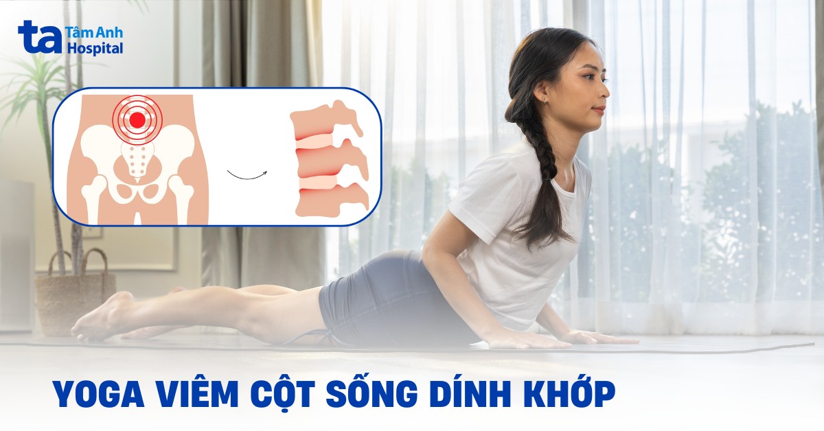 8 tư thế yoga cho viêm cột sống dính khớp