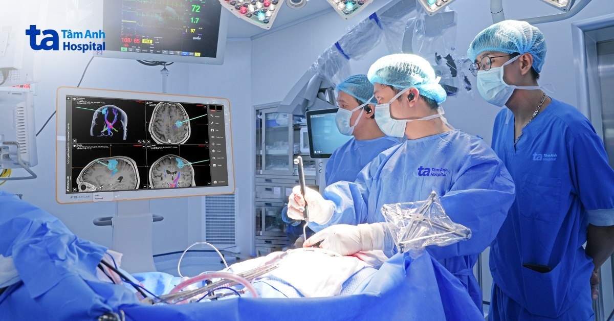 4 công nghệ liên hoàn hỗ trợ phẫu thuật ung thư di căn não