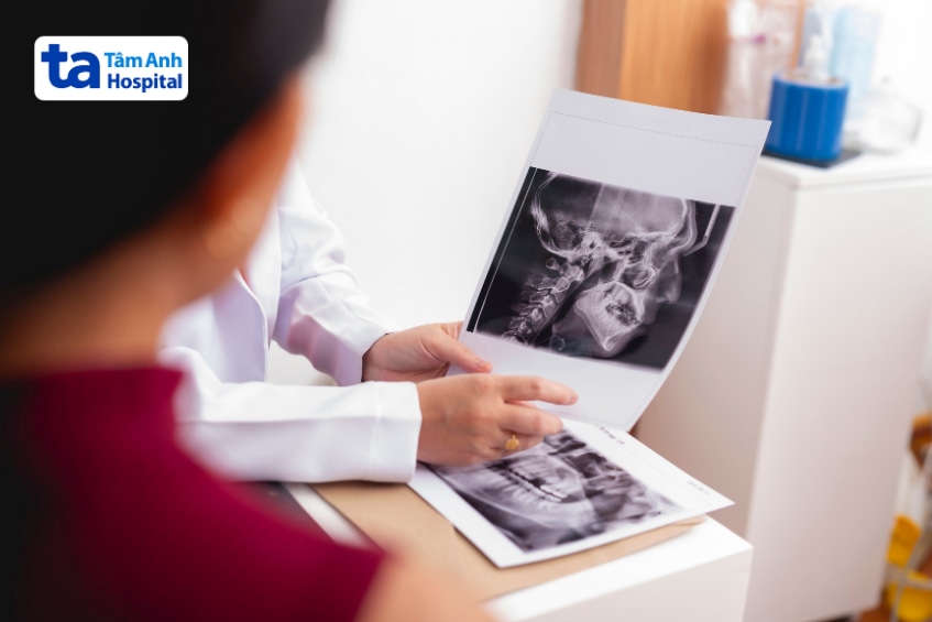 Bác sĩ xem phim X-quang sọ và hàm để chẩn đoán bệnh lý khớp hàm