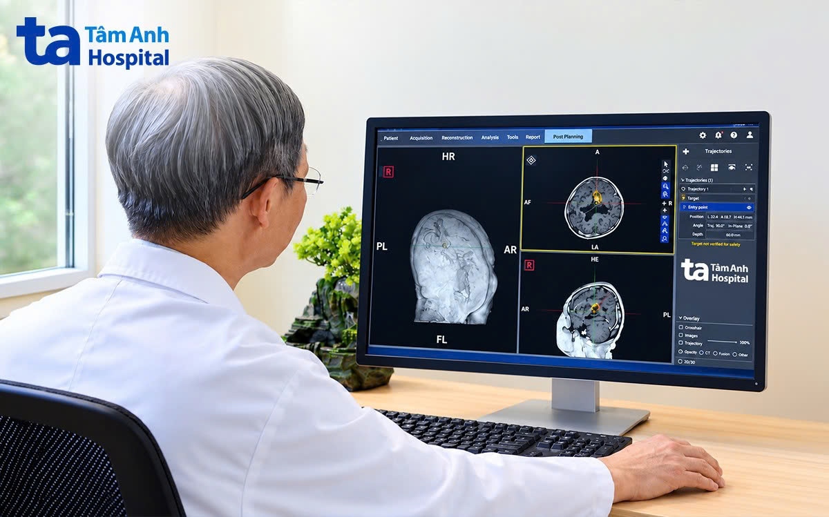 bác sĩ đưa dữ liệu hình ảnh não của người bệnh vào phần mềm robot