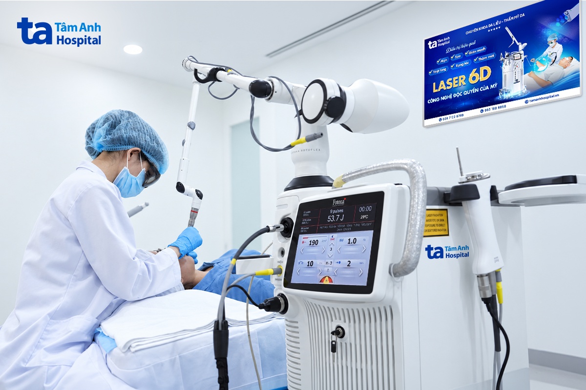 bác sĩ sử dụng laser 6D để điều trị vết sẹo đỏ cho chị thu