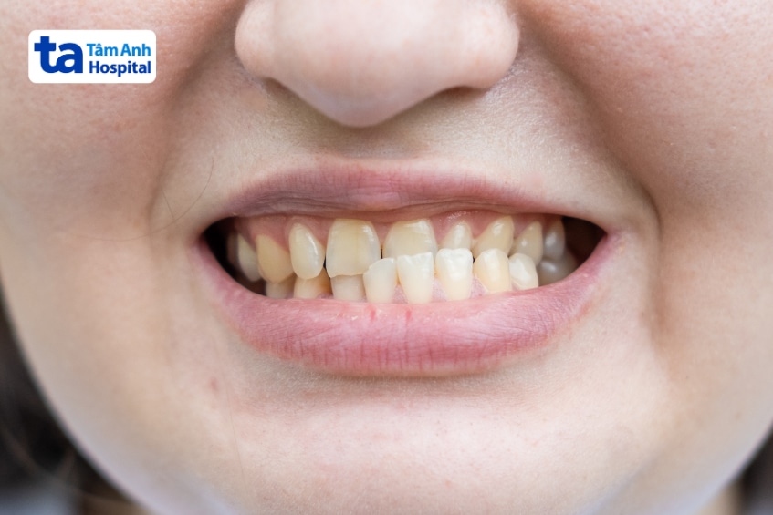 Bác sĩ tư vấn phác đồ điều trị cho người bệnh bên mô hình hàm răng