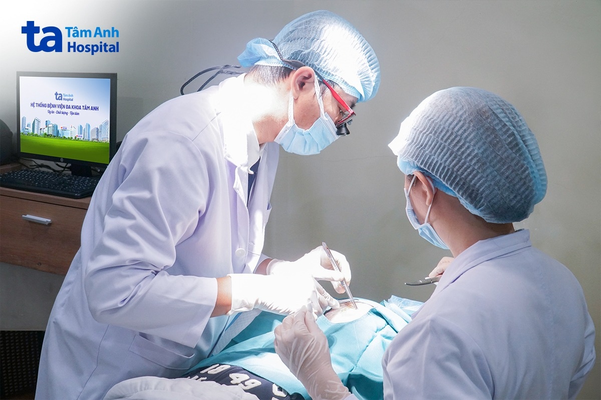 bác sĩ vũ phẫu thuật lấy bỏ nốt kén cho thủy