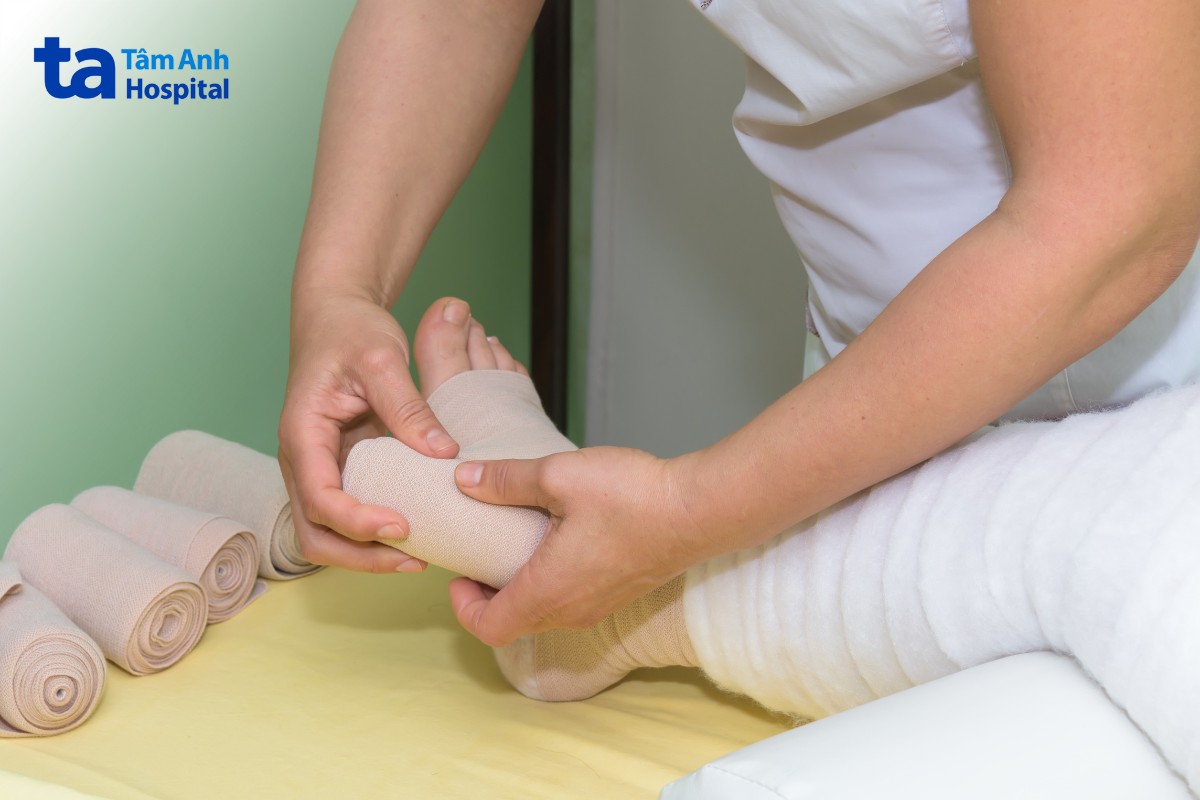 Băng Ép Có Thể Hỗ Trợ Kiểm Soát Phù Bạch Huyết