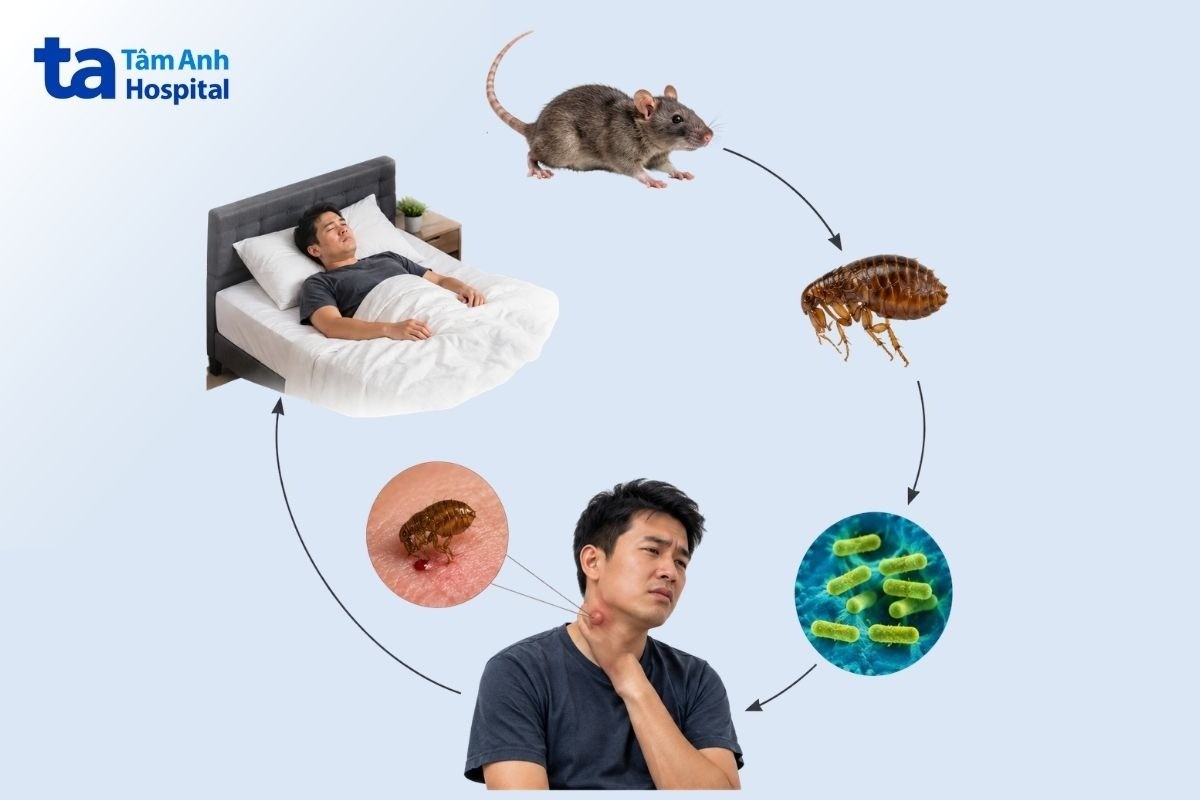 con đường truyền bệnh dịch hạch