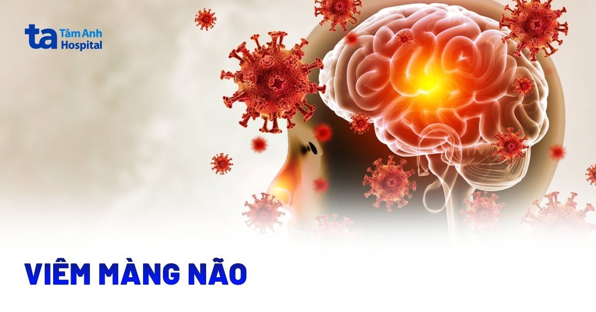Viêm màng não là gì? Dấu hiệu, nguyên nhân và chẩn đoán