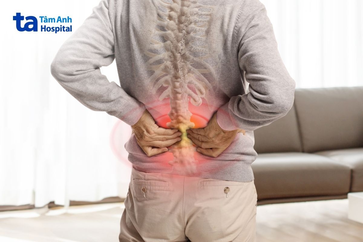 Bị Ngã Chùn Cột Sống