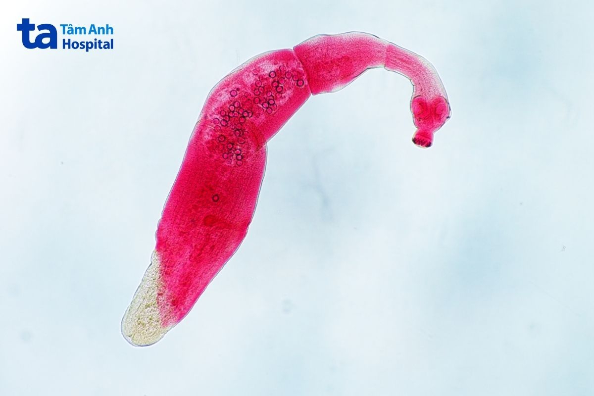 bị nhiễm Echinococcus