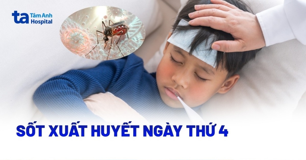 Mắc bệnh sốt xuất huyết ngày thứ 4 nên làm gì?