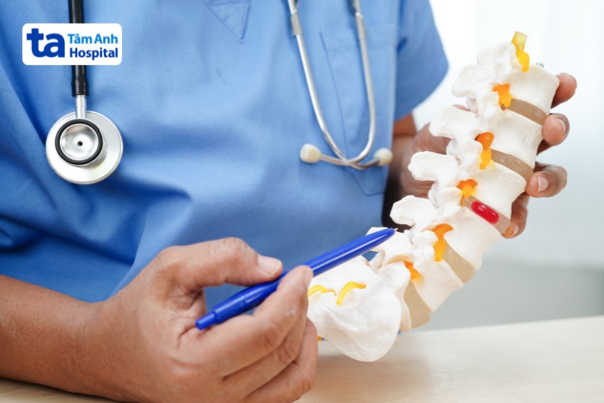 Biến Chứng Thoái Hóa Cột Sống Thắt Lưng