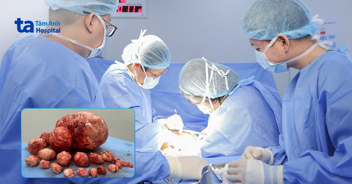 Bóc 25 khối u, giữ tử cung cho người phụ nữ chưa sinh con