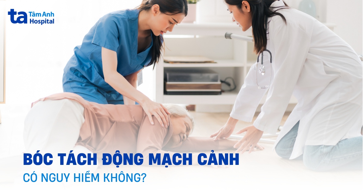 Bóc tách động mạch cảnh: Những thông tin quan trọng