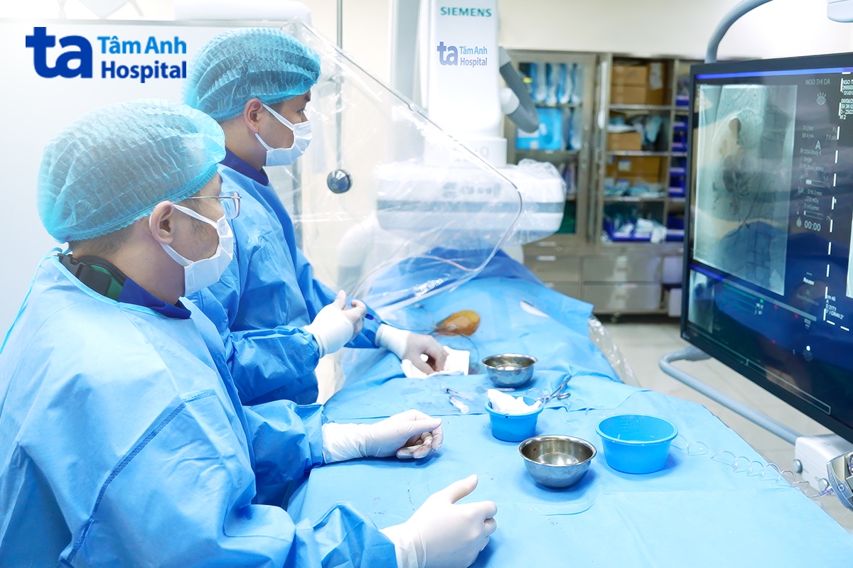 ca thực hiện đặt nút mạch u gan