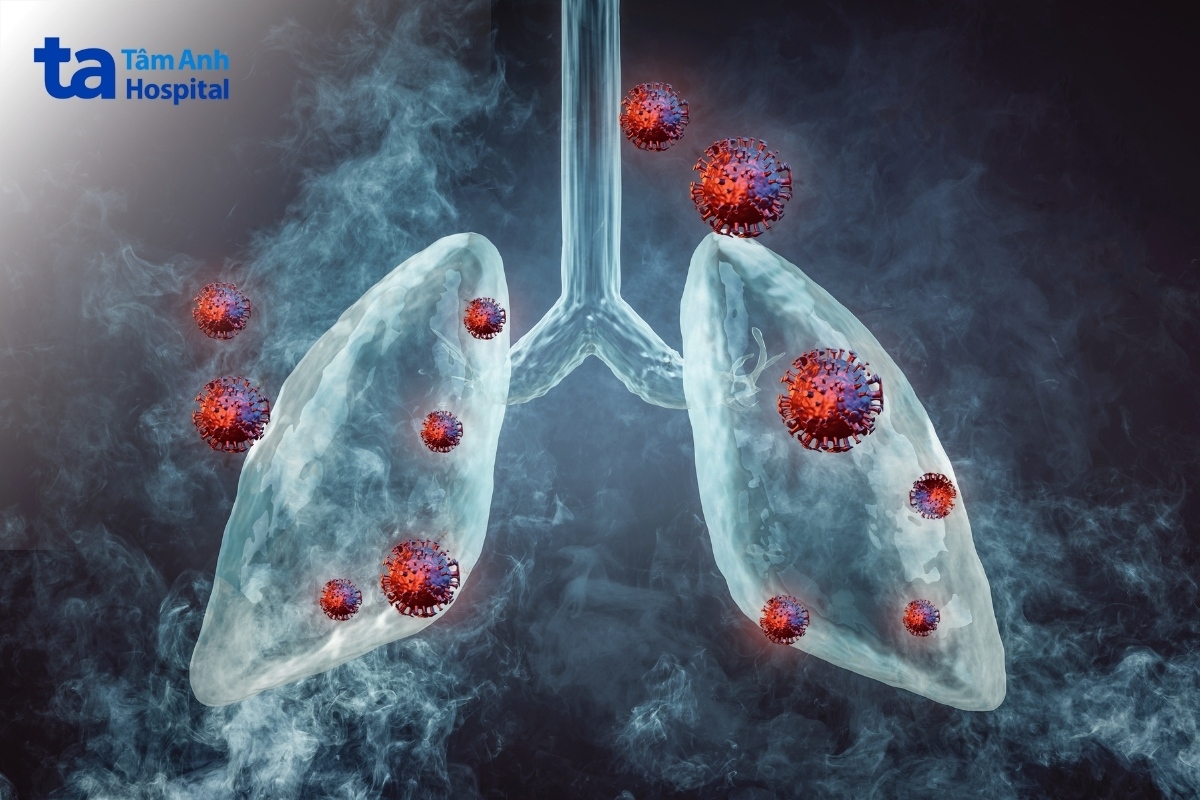 các bệnh lý hô hấp như viêm phổi, viêm phế quản hoặc đợt cấp copd