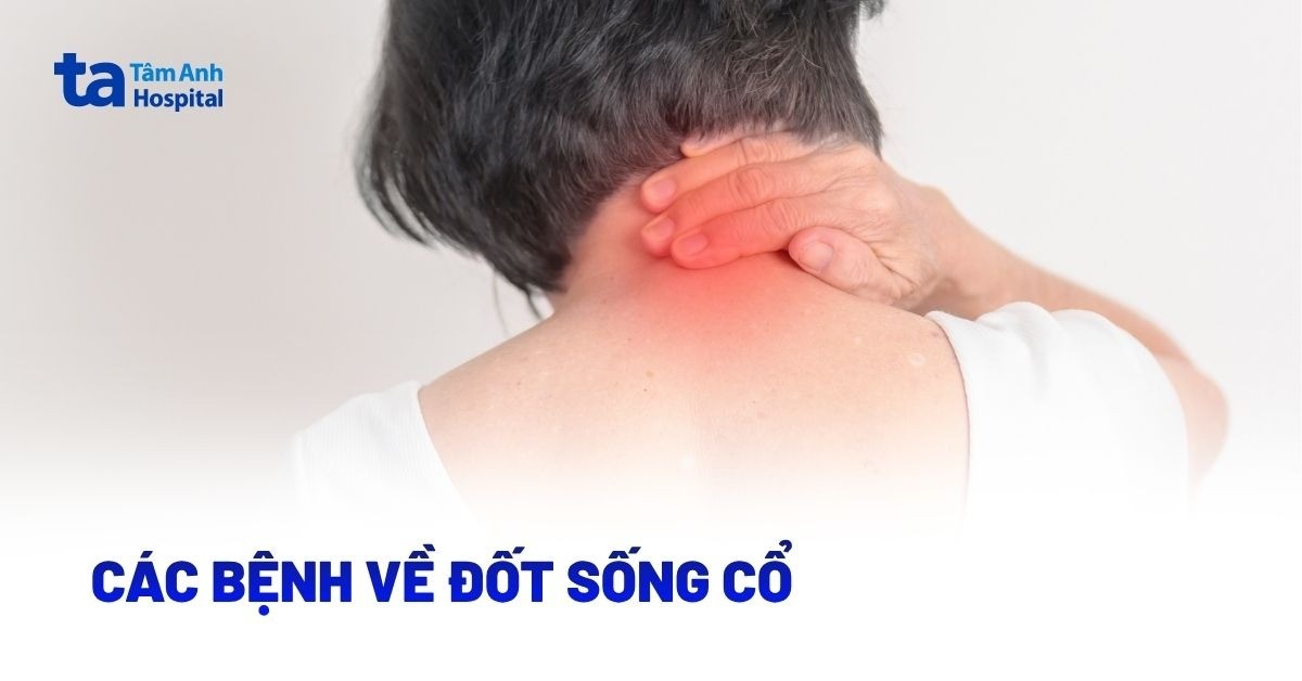 Các bệnh về đốt sống cổ gồm những bệnh nào?