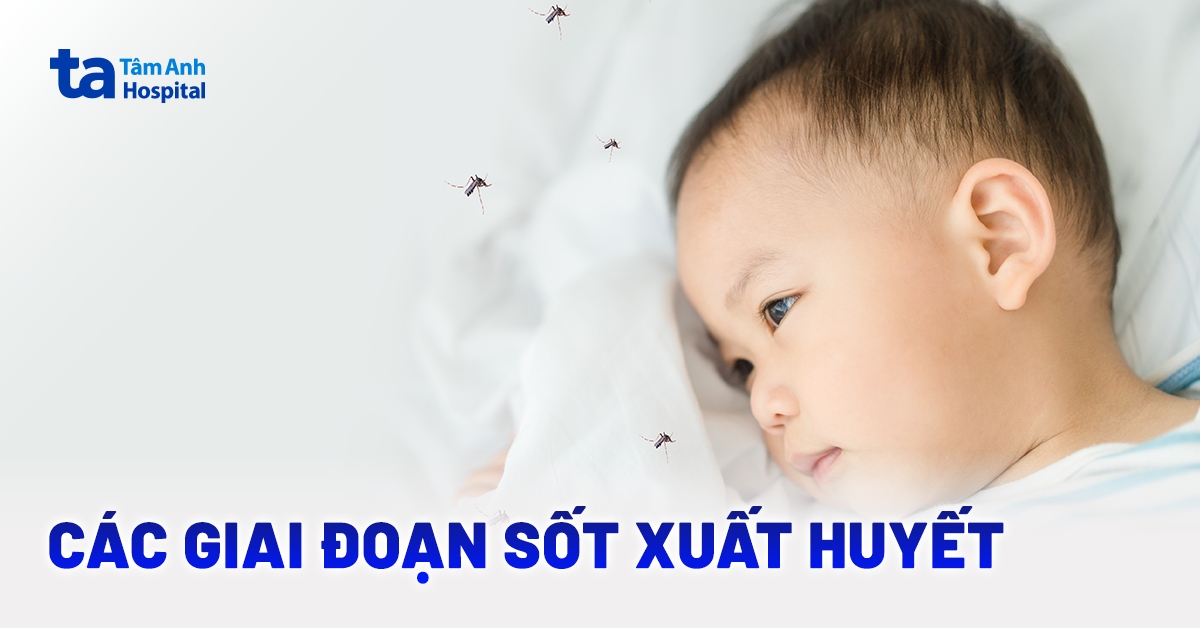 Tìm hiểu các giai đoạn sốt xuất huyết