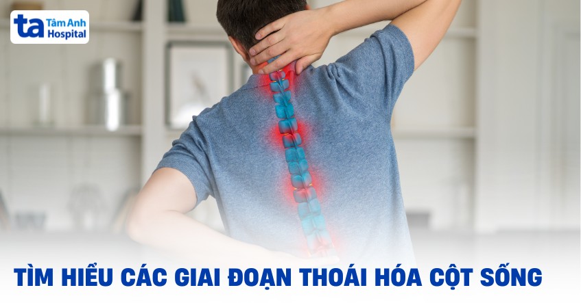 Các Giai Đoạn Thoái Hóa Cột Sống​
