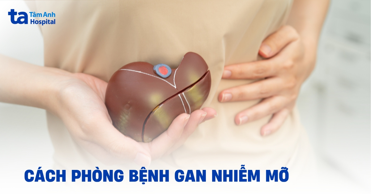 Cách phòng bệnh gan nhiễm mỡ để bảo vệ sức khỏe