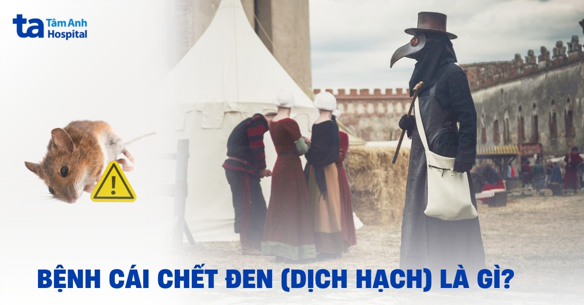 Dịch Cái chết Đen là gì? Có tồn tại đến ngày nay không?