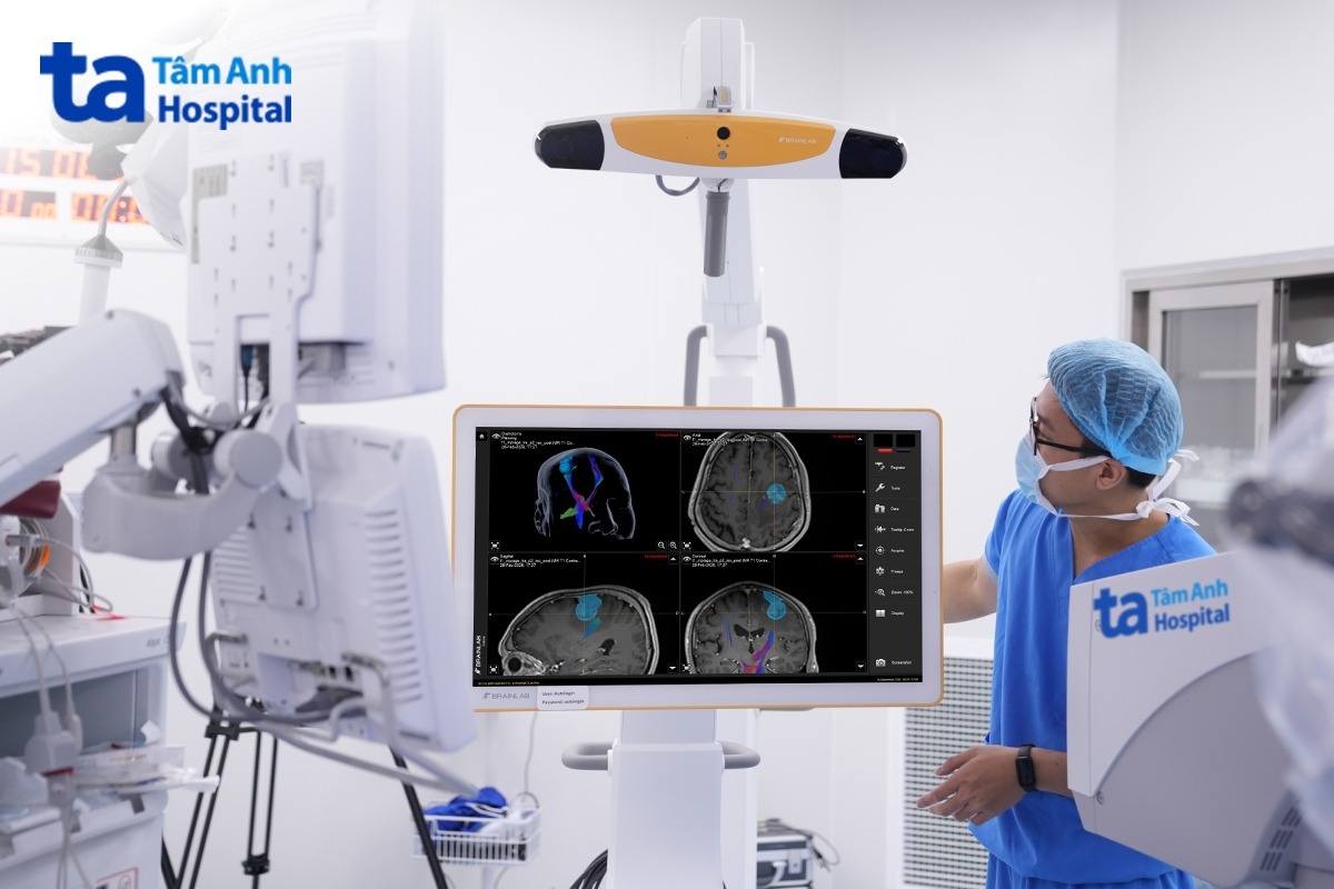 camera của neuro-navigation curve brainlab dẫn đường phẫu thuật u não