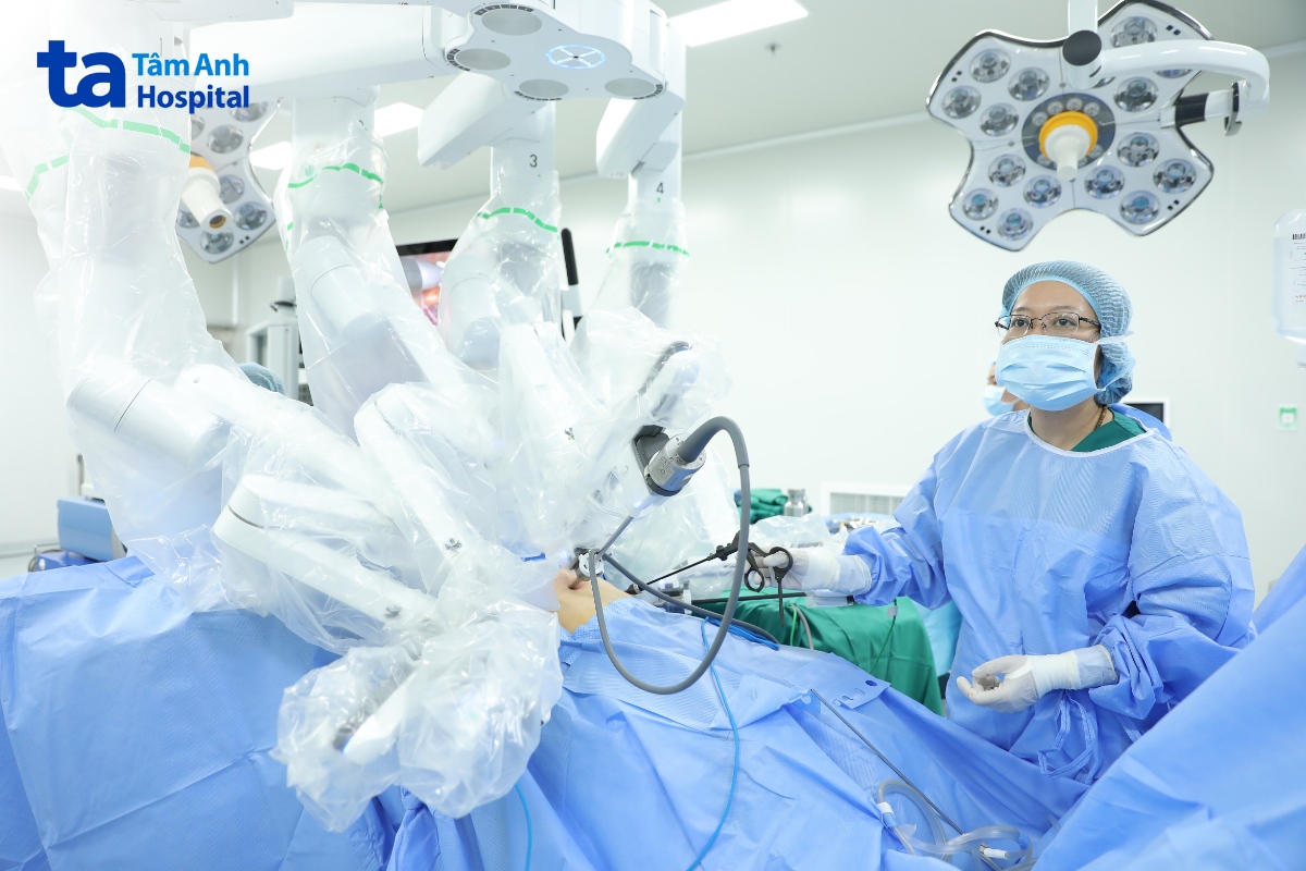 cánh tay robot có góc quay tự do lên đến 540 độ gập góc linh hoạt