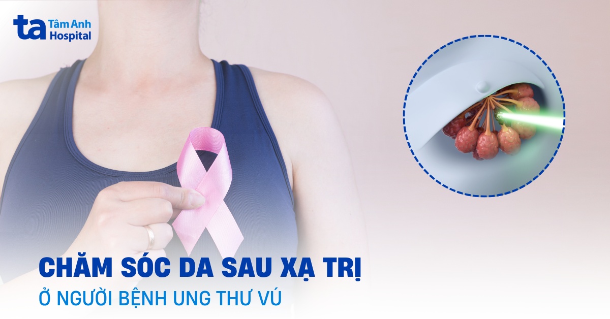 Chăm Sóc Da Sau Xạ Trị Ở Người Bệnh Ung Thư Vú