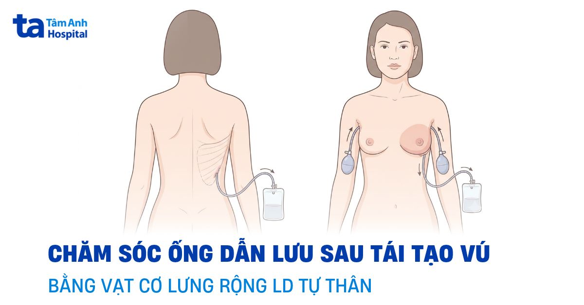 Chăm Sóc Ống Dẫn Lưu Sau Tái Tạo Vú Bằng Vạt Cơ Lưng Rộng