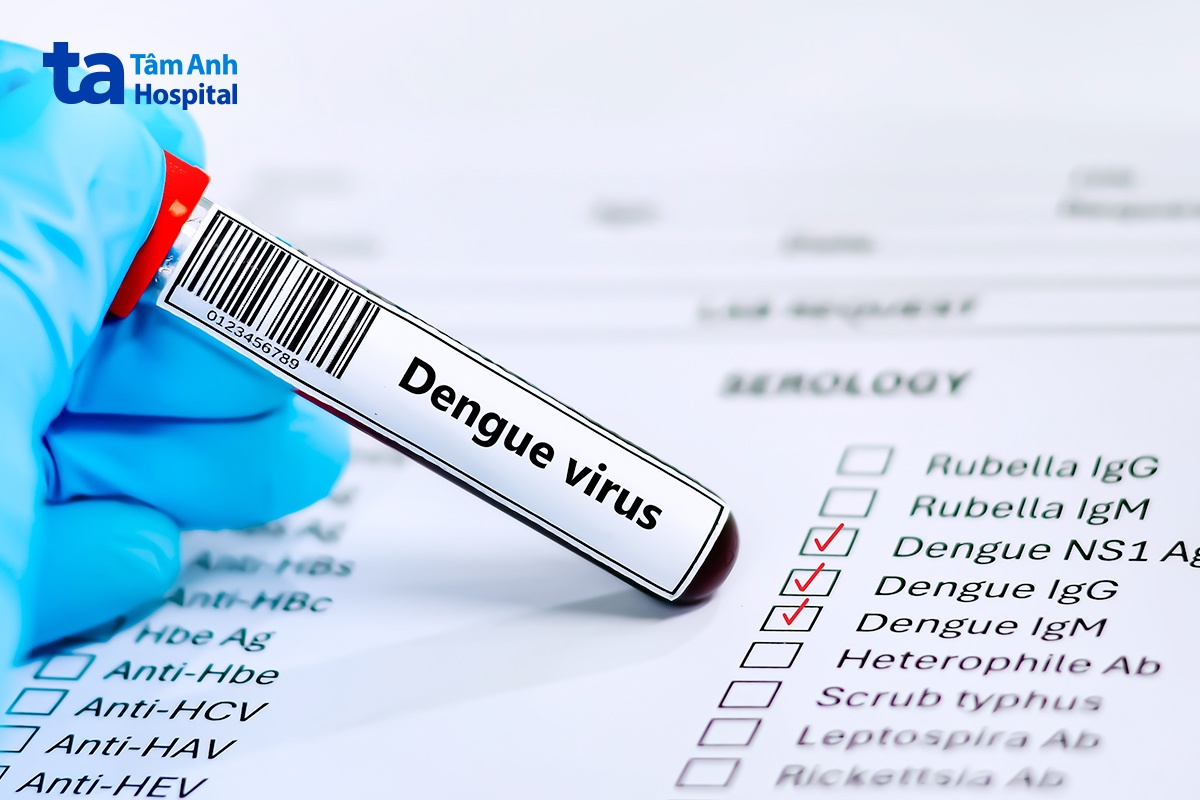 Chẩn Đoán Sớm Sốt Dengue
