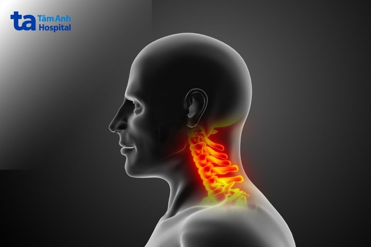 chấn thương cột sống cổ​ ảnh hưởng cấu trúc cổ