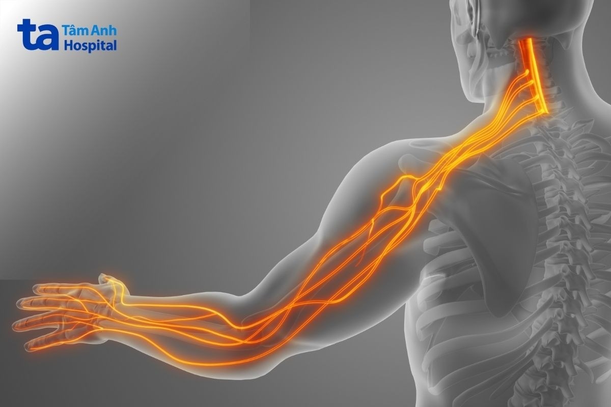 chấn thương cột sống cổ​ gây tê bì và yếu cơ