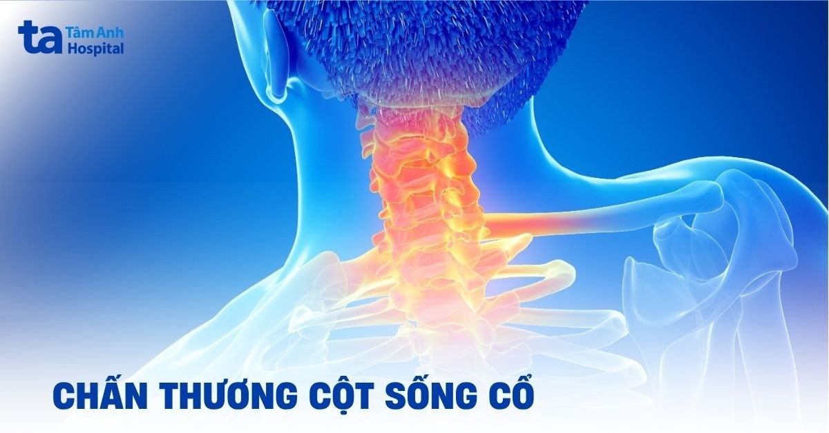 Chấn thương cột sống cổ cần xử trí như thế nào?