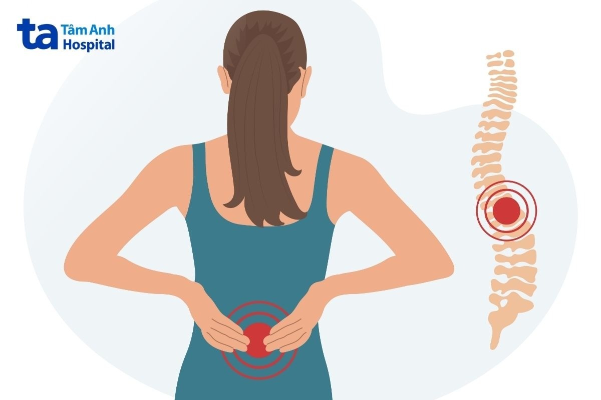 chấn thương cột sống không nên quan hệ