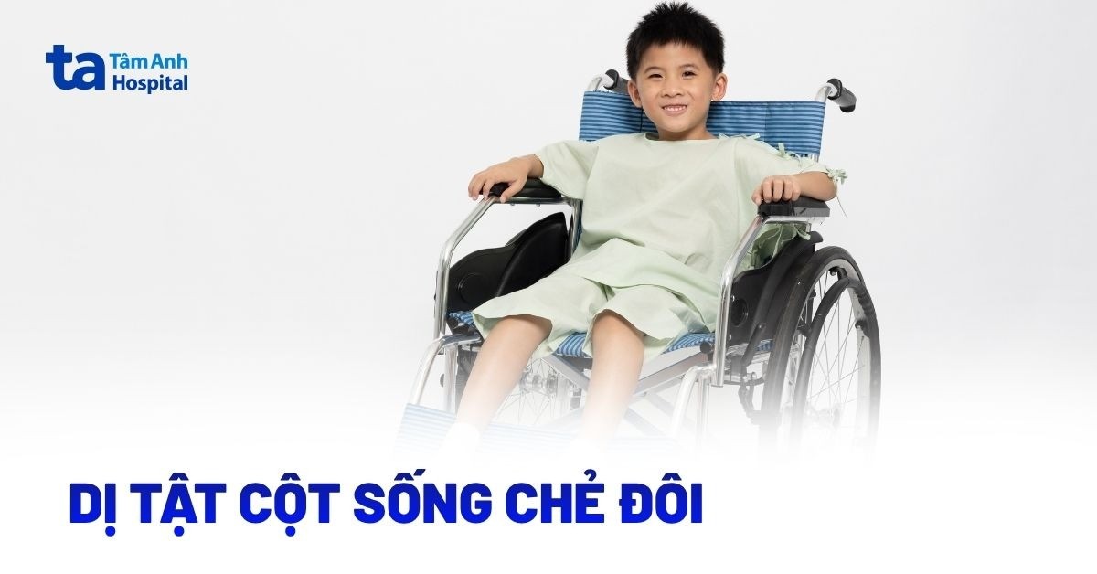 Dị tật cột sống chẻ đôi là gì? Những điều cha mẹ cần biết