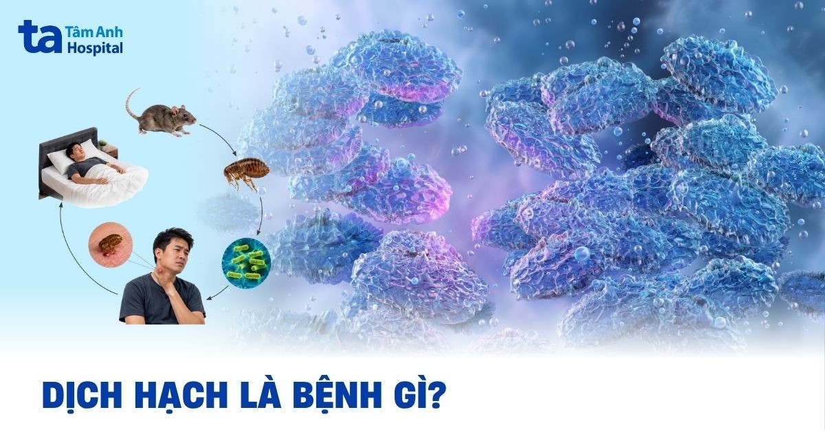 Dịch hạch là bệnh gì? Nguyên nhân, triệu chứng và điều trị