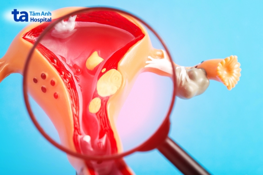 estrogen và progesterone mất cân bằng