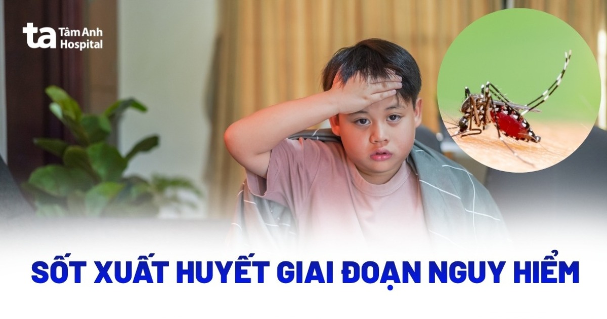 Cảnh báo giai đoạn nguy hiểm của sốt xuất huyết bạn cần biết ngay