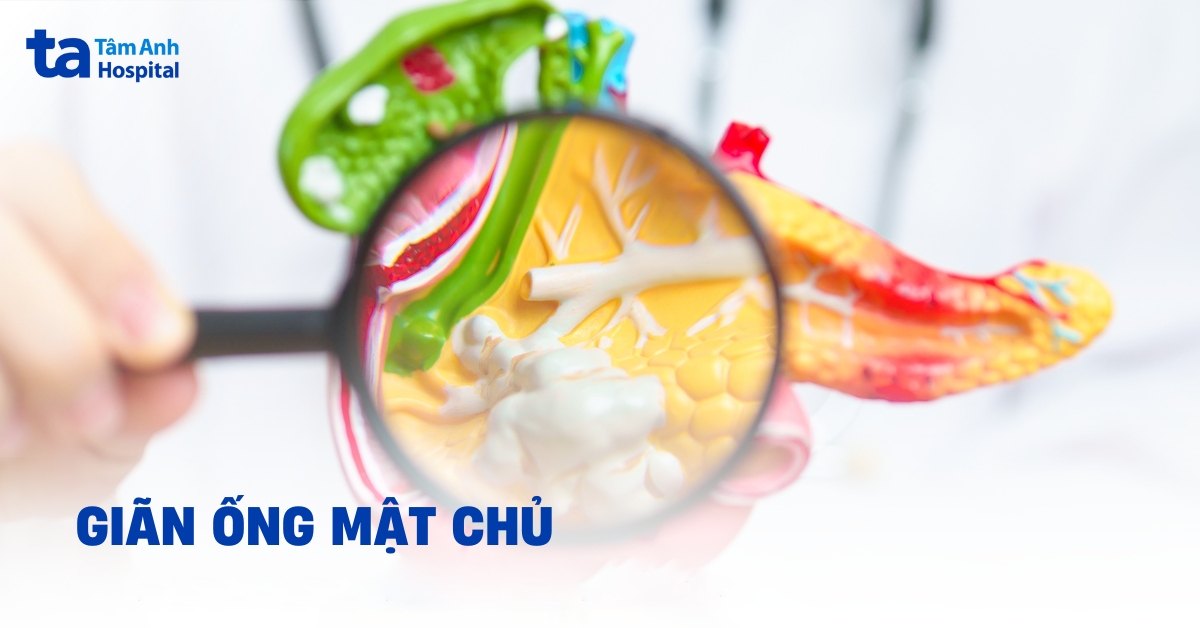 Giãn ống mật chủ: Những điều cần biết để phát hiện sớm