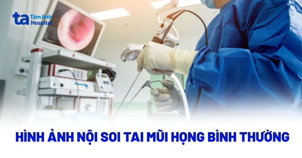 Hình Ảnh Nội Soi Tai Mũi Họng Bình Thường